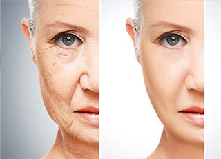 Anti-aging solutions